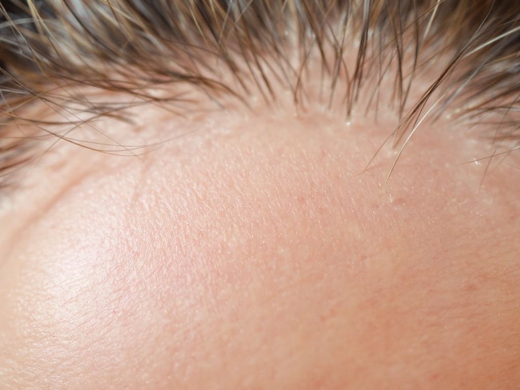 how to stimulate hair follicles